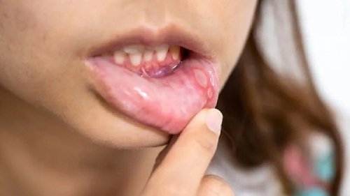 20250224083414_health1