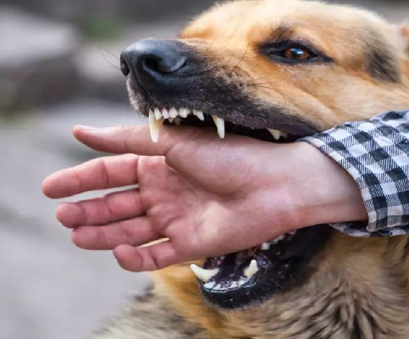 CG : मासूम पर कुत्ते का हमला, गंभीर रूप से घायल बच्चा अस्पताल में भर्ती …