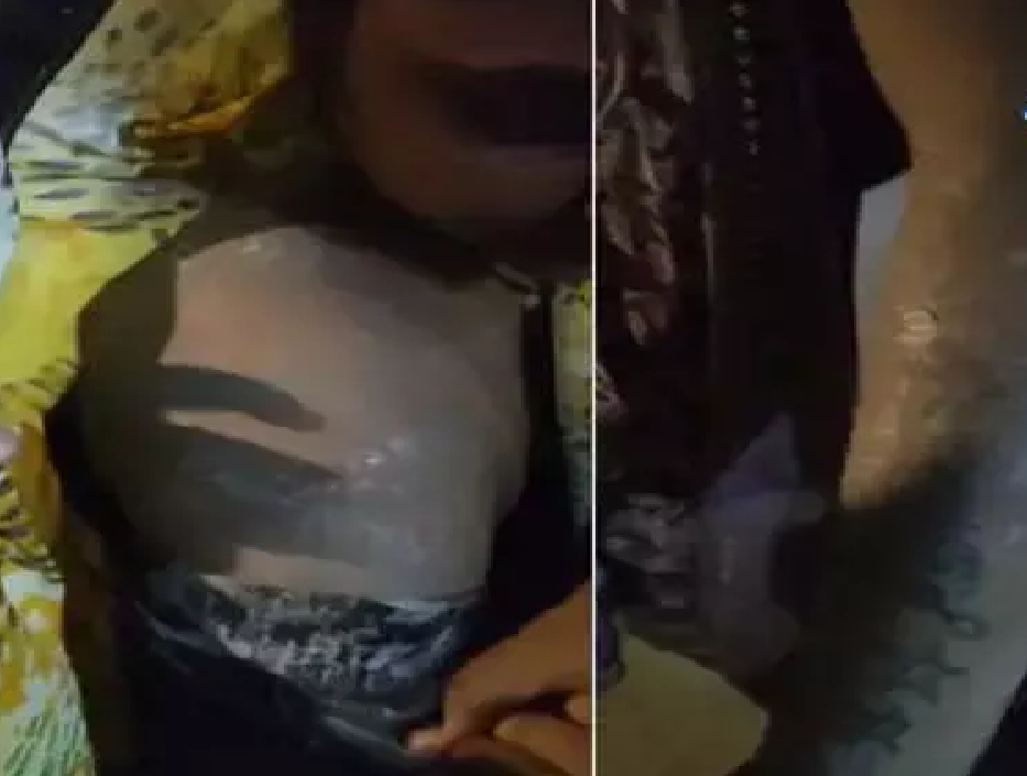 CG : किचन में लगी आग, गैस सिलेंडर का पाइप फटने से हुई बड़ी घटना, कई घायल …